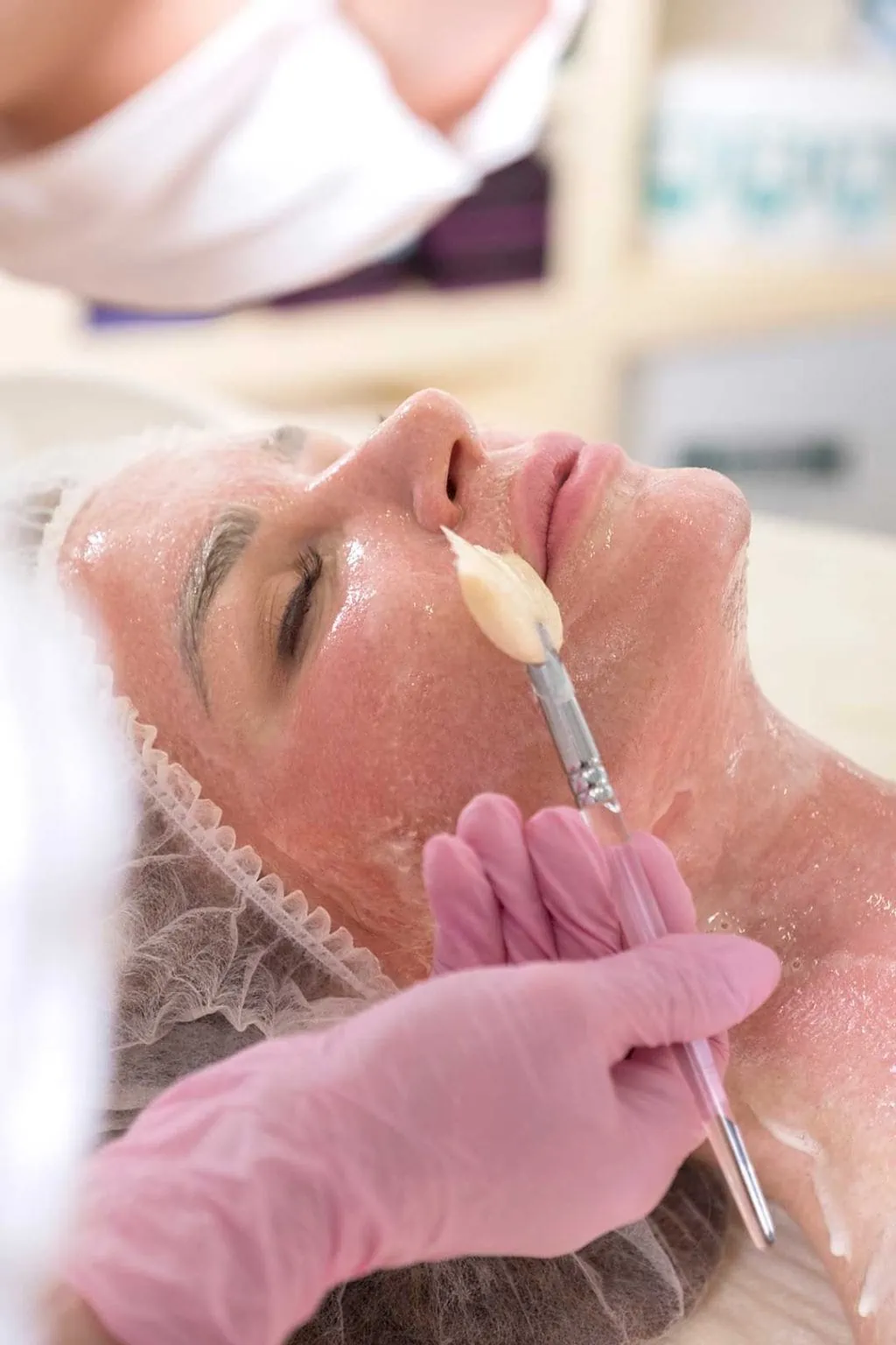 Peeling Retinol